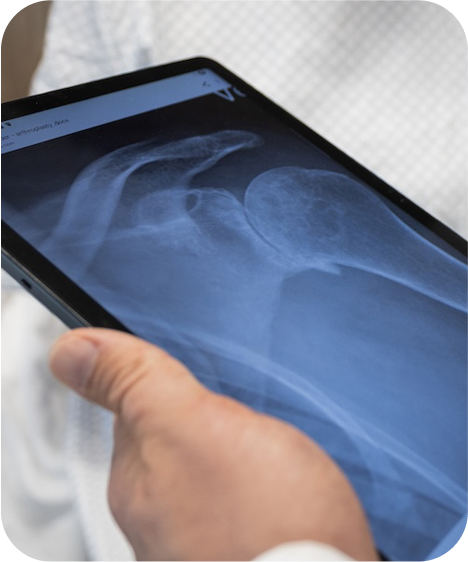 Shoulder Replacement